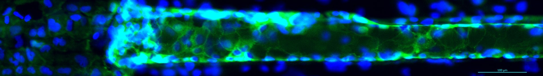 Engineered microvessel stained for ZO-1 (green) and counterstained for nuclei (blue).